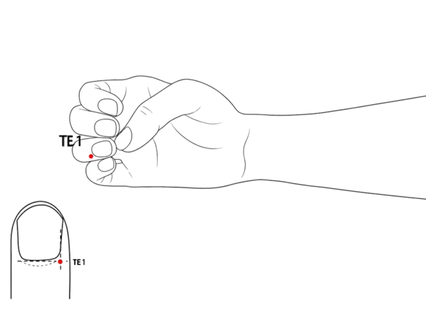 Location illustration for Junction of skin and nail on the ulnar aspect of the fourth digit