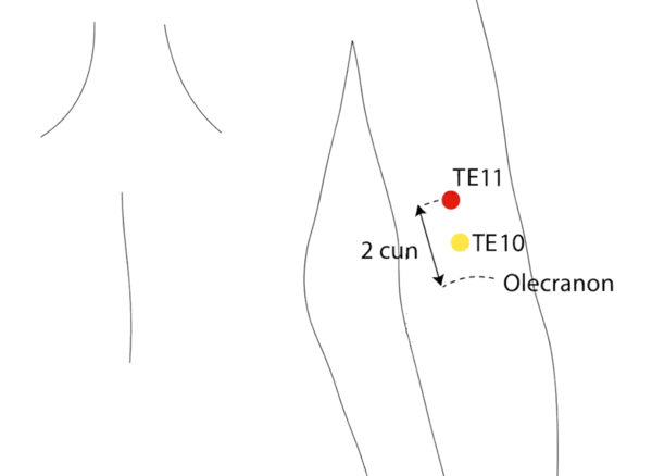 Location illustration for On the posterior upper arm, midway between the elbow and shoulder