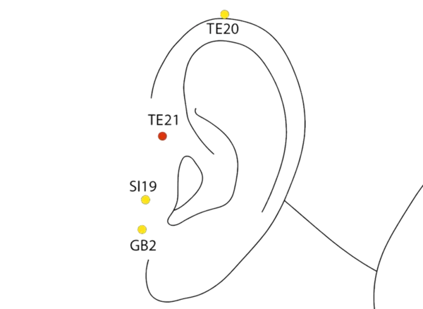 TE-21 - Ear Gate Acupoint Location illustration for Anterior to the ear canal, where the mandible moves during mouth opening