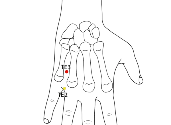 TE-3 - Central Islet Acupoint Location illustration for Between the fourth and fifth metacarpal bones, proximal to the MCP joints
