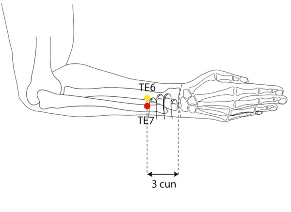 Location illustration for On the dorsal forearm, between radius and ulna, level with TE-6 but slightly radial